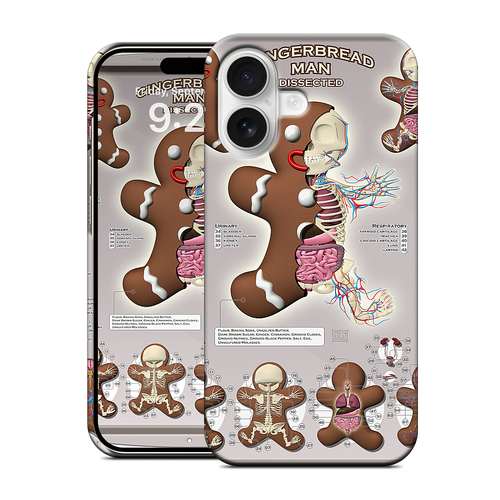 Gingerbread Man Dissected iPhone Case