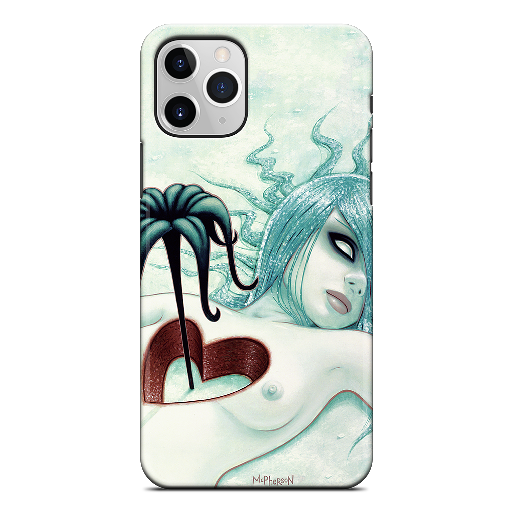 Hey We All Die Sometimes iPhone Case