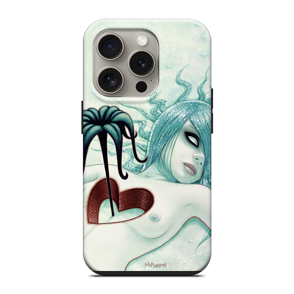 Hey We All Die Sometimes iPhone Case