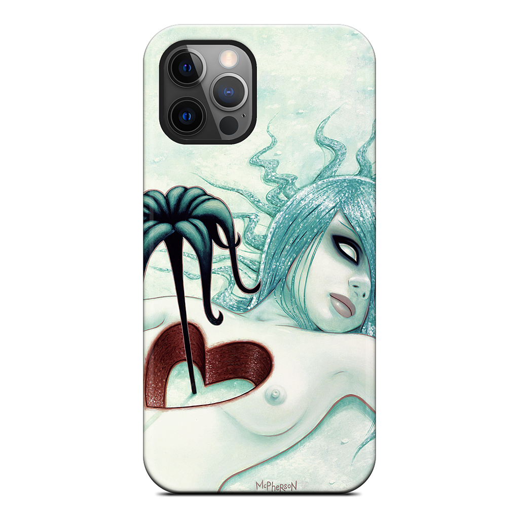 Hey We All Die Sometimes iPhone Case
