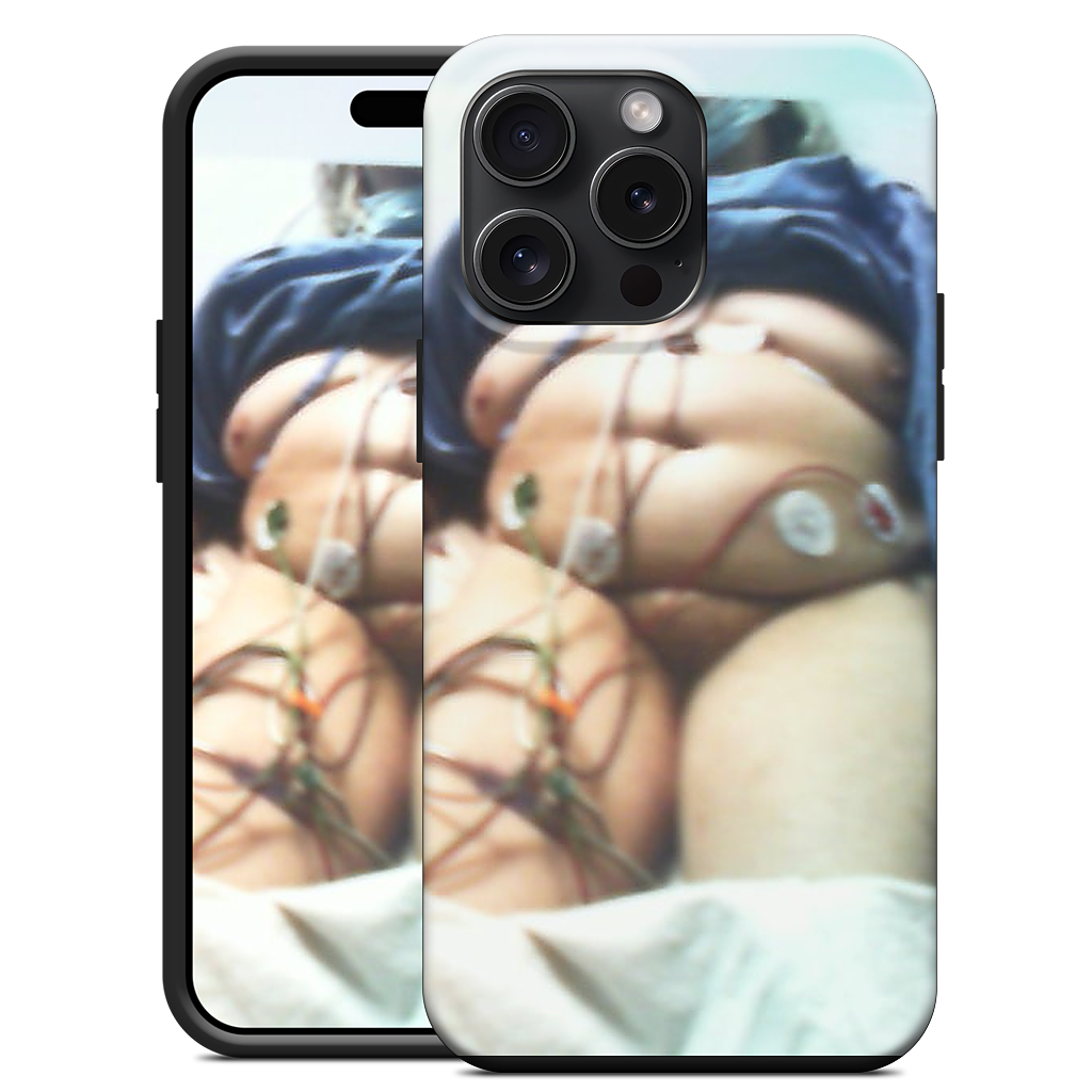 Custom iPhone Case - da633098