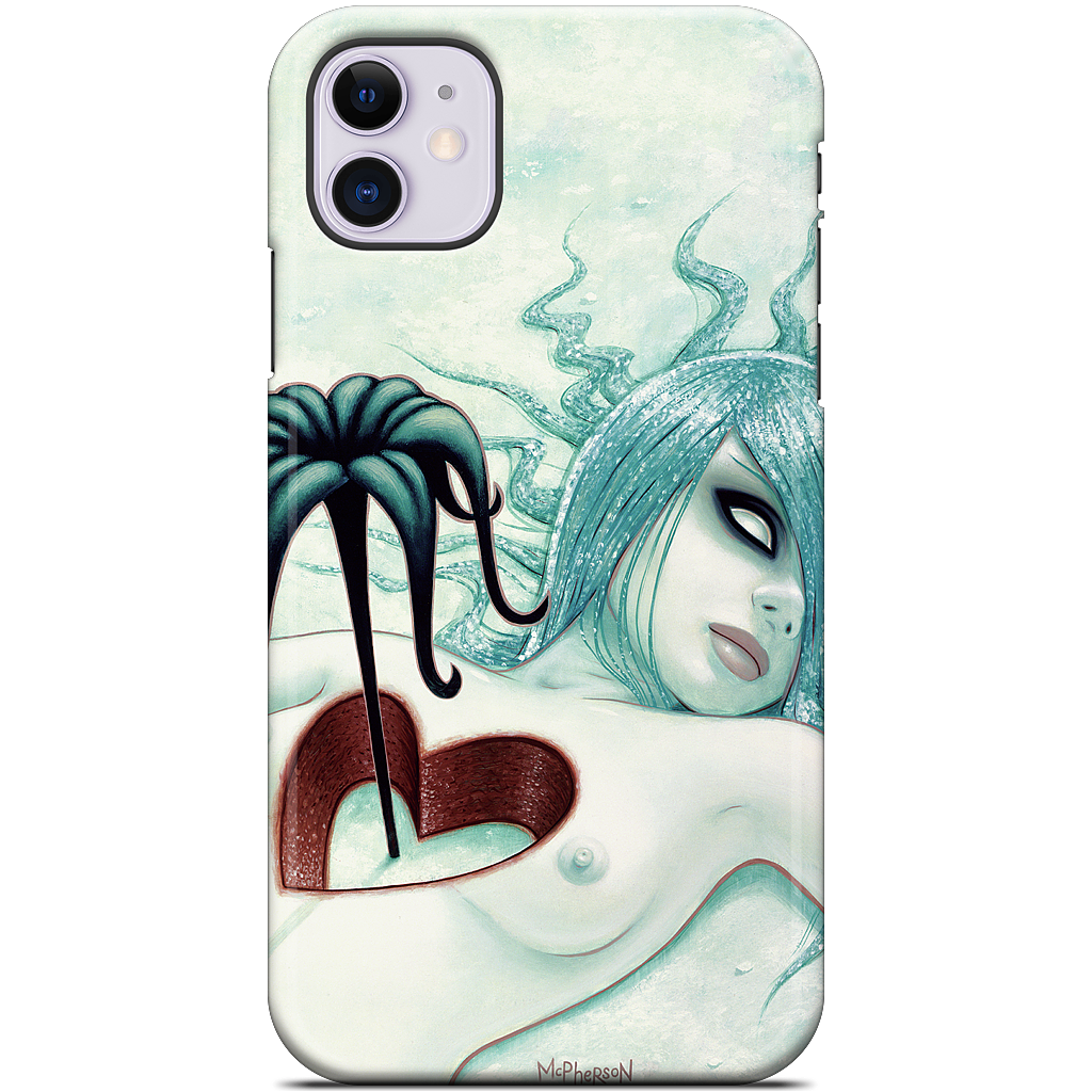Hey We All Die Sometimes iPhone Case