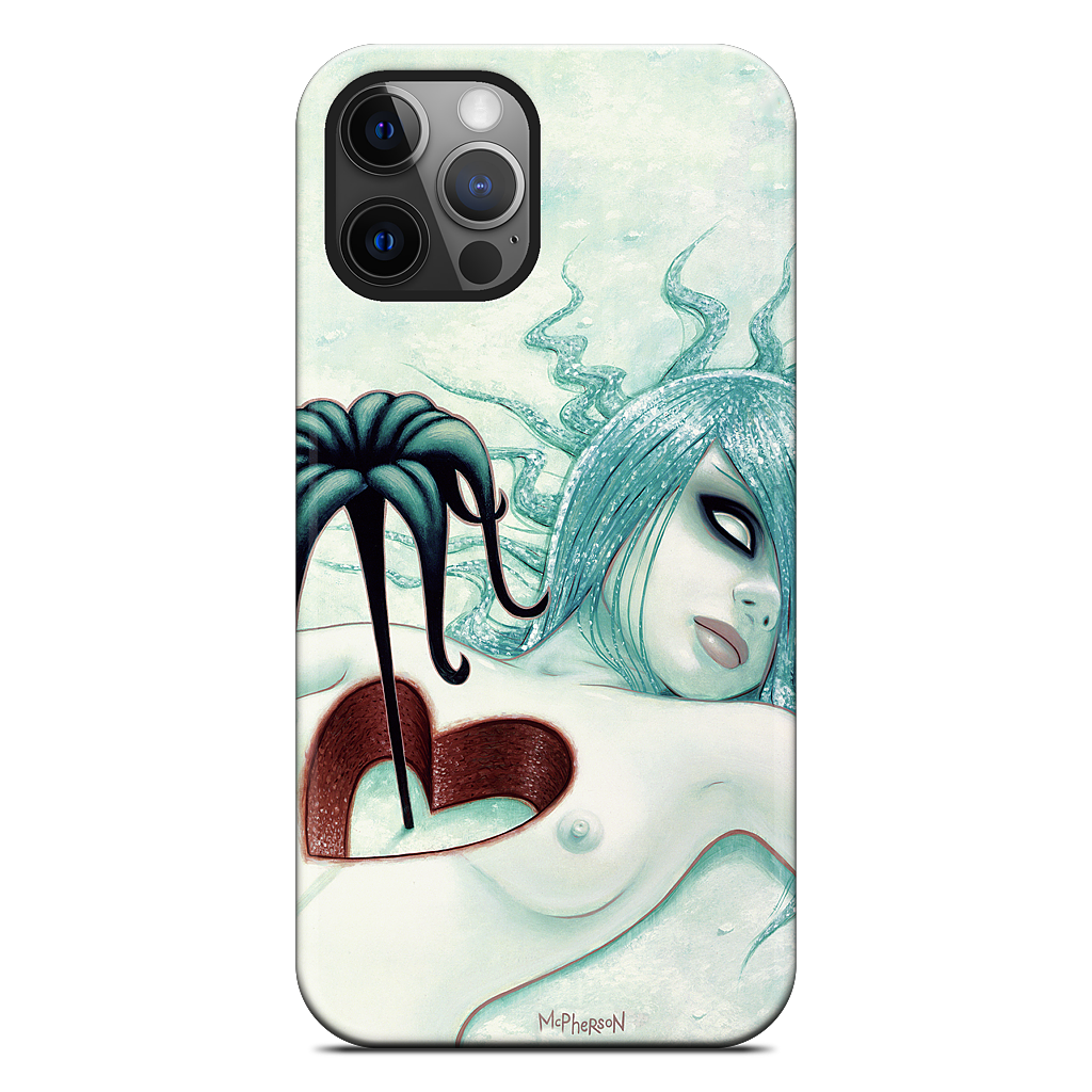 Hey We All Die Sometimes iPhone Case