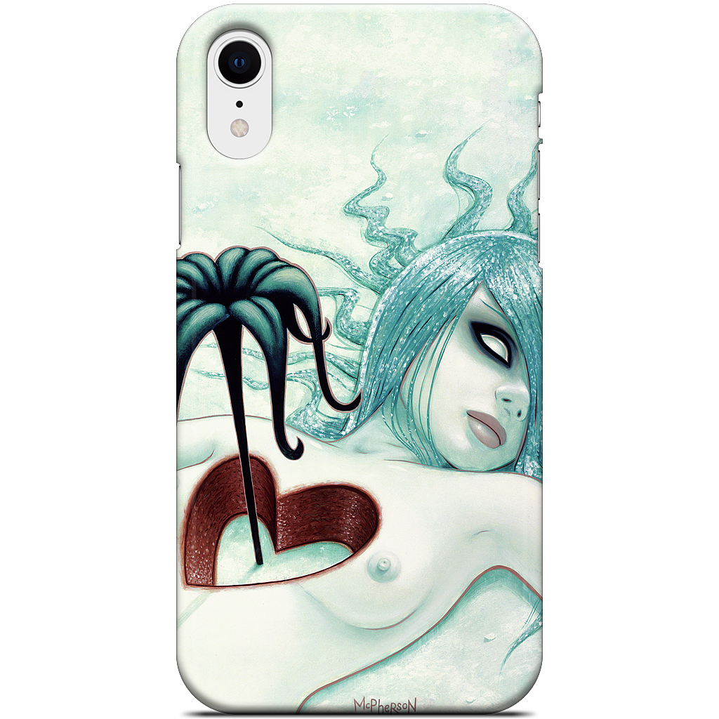 Hey We All Die Sometimes iPhone Case