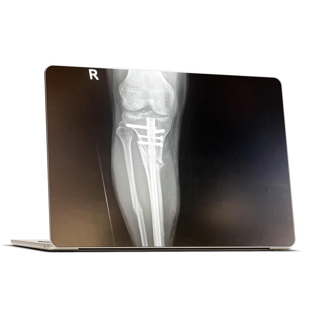 Custom MacBook Skin - 2b2e0673